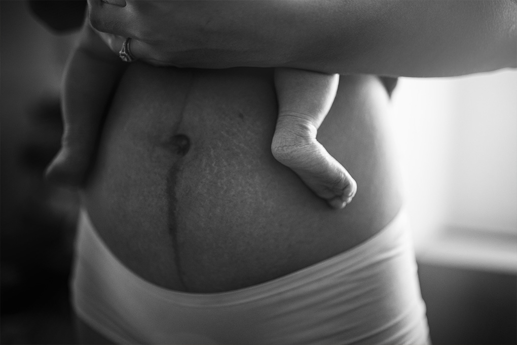 Postpartum Recovery What No One Tells You (But Should)